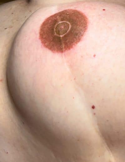 medizinische-Tattoos-Beispiel-02