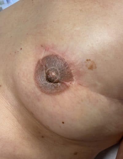 medizinische-Tattoos-Beispiel-05