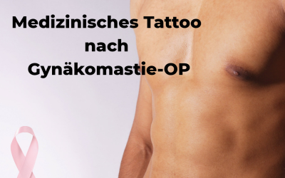 Medizinisches Tattoo nach einer Gynäkomastie-OP: Was ist möglich?